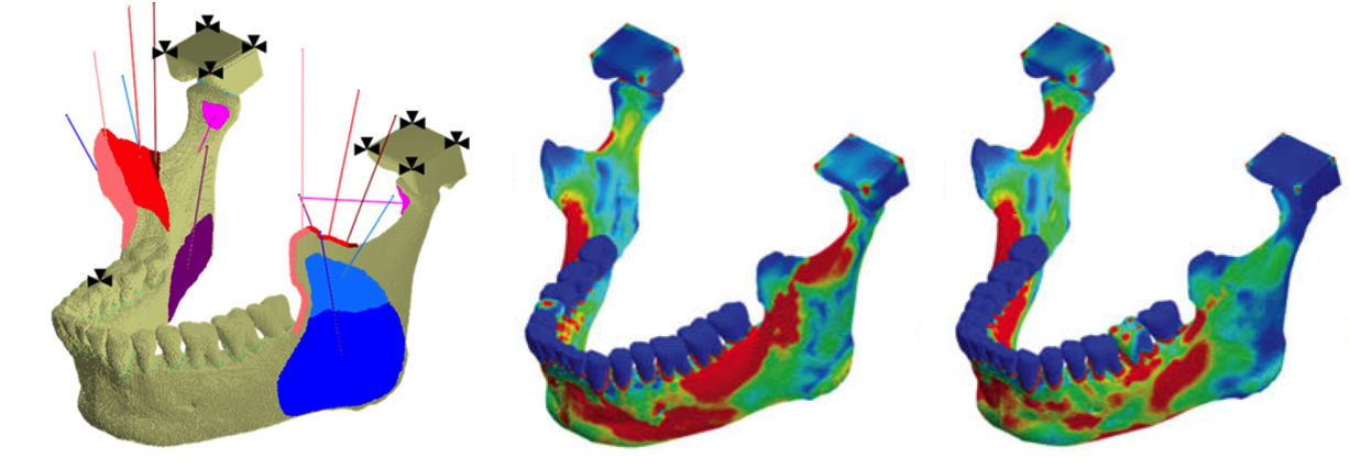 Simulation of a human mandible and sample strain distributions from biting on different teeth