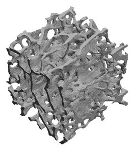 A finite element mesh of a trabecular bone specimen